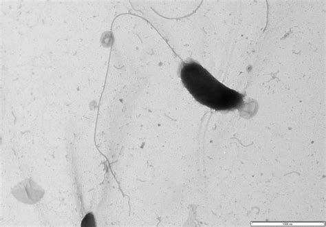 5 (A shows a part of a bacterial cell wall and flagella that were ...