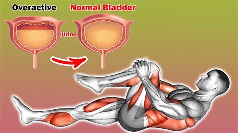 Benign Prostatic Hyperplasia Bph Standard American Urological Association