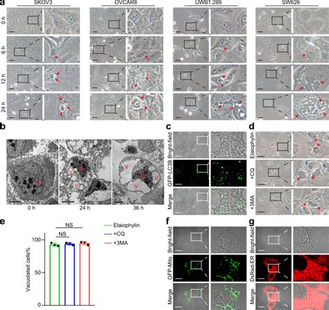 Elaiophylin Triggers Paraptosis And Preferentially Kills Ovarian Cancer