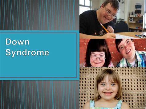 Down Syndrome Ppt For Ugs