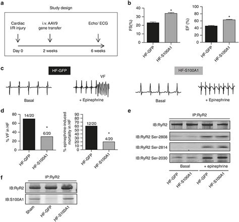 S100a1 Protects Against Epinephrine Triggered Ventricular Download Scientific Diagram