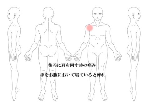 右肩の痛み 症例 那覇市 鍼灸 沖縄の那覇にある當山鍼灸院が、腰や肩、背中の痛みを針治療で改善