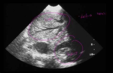 Diagnostic imaging final Flashcards | Quizlet