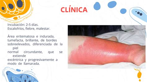 Infecciones De Piel Y Partes Blandas Pptx