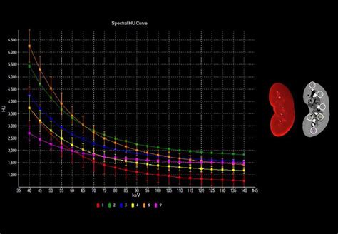 Slice Spiral Ct Scanner