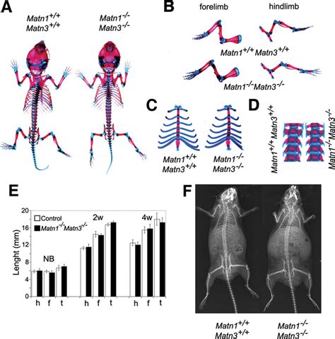 Skeletal Analysis Of Matn1matn3 Double Deficient Mice A Whole Mount