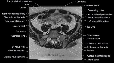 Mri Female Pelvis Anatomy