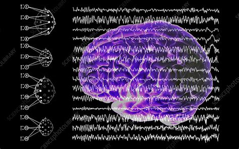 Brain and brain waves in epilepsy - Stock Image - M150/0273 - Science Photo Library