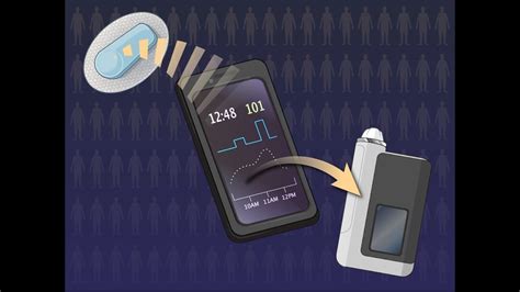 Open Source Automated Insulin Delivery In Type 1 Diabetes NEJM YouTube