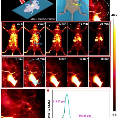 A Schematic Illustration Of Non Invasive Nir Ii Imaging Guided Tumor