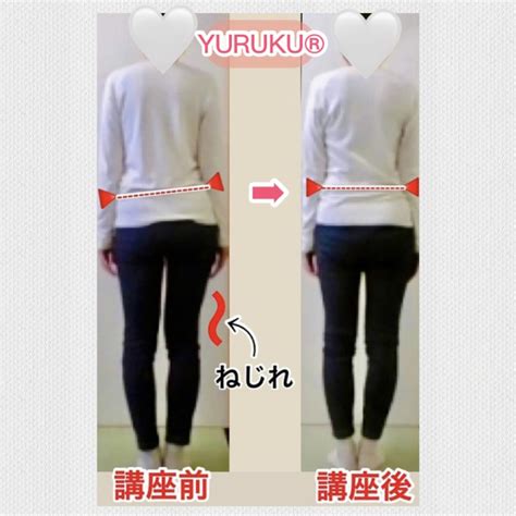 足の長さが違う・腰の高さが違う（パーソナルレッスン） Yuruku®️ウォーク 姿勢改善・歩き方矯正教室