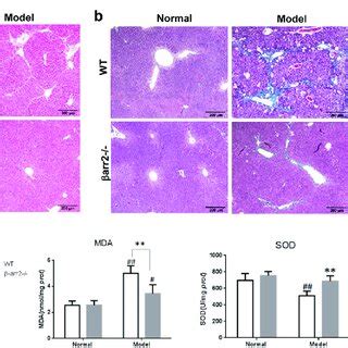 Arrestin Deficiency Ameliorated Ccl Induced Liver Fibrosis In