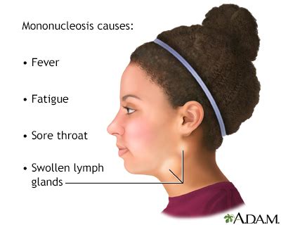 Swollen Lymph Nodes Years After Mono