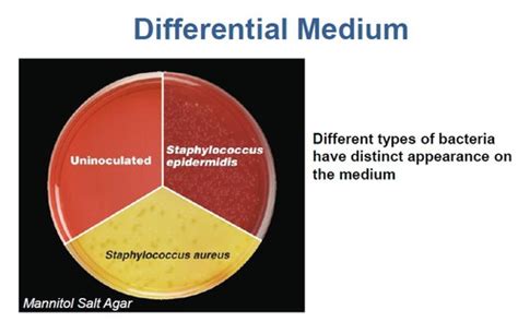 Chapter Classification Of Microorganisms Flashcards Quizlet