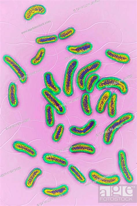 Vibrio Cholerae Microscope