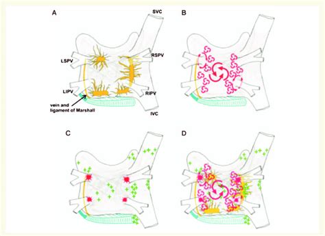 Structure And Mechanisms Of Atrial Fibrillation Shown In Figure 1A Is