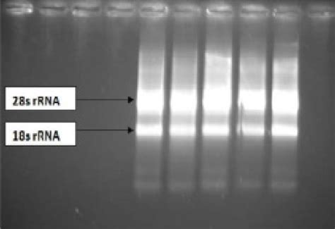 Rna Gel Electrophoresis Download Scientific Diagram