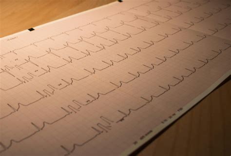 Ekg Simulation We Simt Ekg 1224