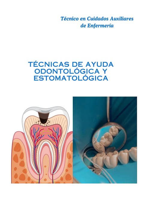 SOLUTION T Cnicas De Ayuda Odontol Gica Y Estomatol Gica Studypool