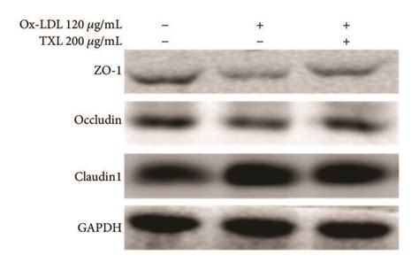 Txl Improved Ox Ldl Induced Tight Junction Proteins Expression In