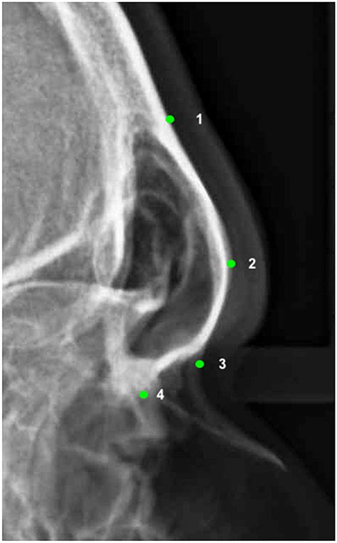 The Landmarks Used In The Geometric Morphometric Analysis As Traced On