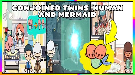 Mom Gave Birth To Conjoined Twins Human And Mermaid Sad Story Toca