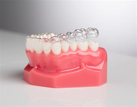 Invisalign the king of Clear Aligners | Dr. Nechupadam Dental Clinic