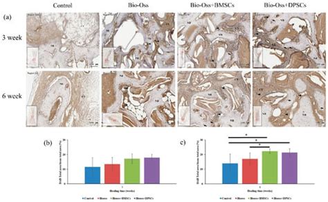 IJMS | Special Issue : Dental Pulp Stem Cells: Unveiling Their ...