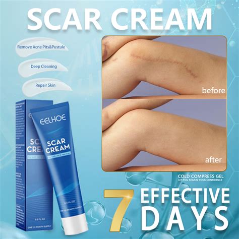 Scars Remover For Old Scars Fix Scar Removal Original Scar Remover Fix