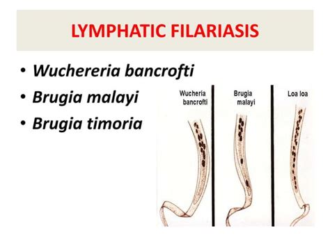 Filarial worms dr. rs 28 08-2017 | PPT