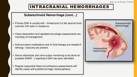 Neonatal Intracranial Hemorrhage By Dr Sonali Mhatre