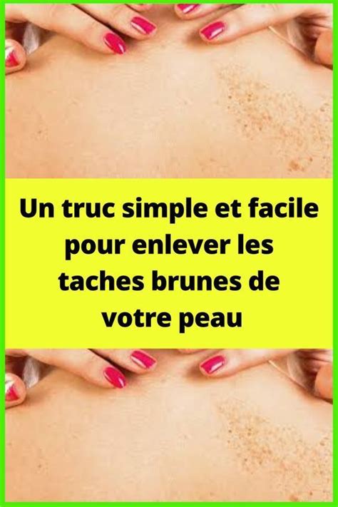 Un Truc Simple Et Facile Pour Enlever Les Taches Brunes De Votre Peau