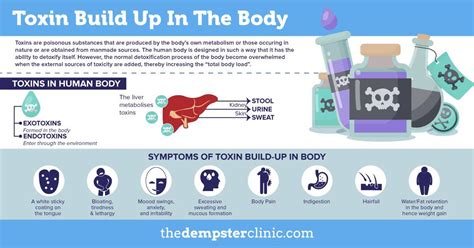 Toxin Buildup In Body The Dempster Clinic