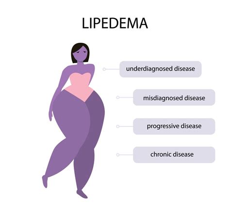 Lipedema Prevalence In Women Lipedema