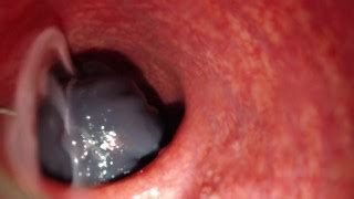 Internal Anal Camera Bad Dragon Flint Fucks And Fills Condom Deep In My Ass Heartbeat Xxx