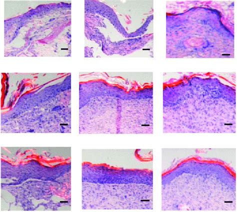 Hande Stained Sections Of Healing Wounds At 7 14 And 21 Days Post