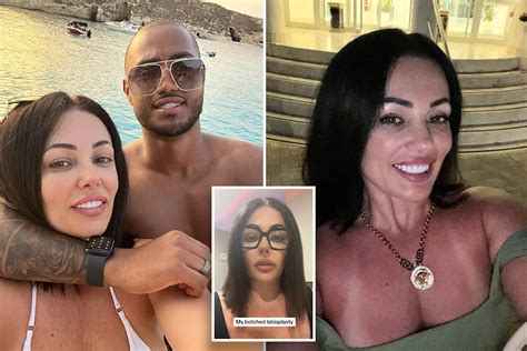 I Got Designer Vagina Surgery After My Ex Said It Was The Worst He Had Ever Seen Now Sex Is