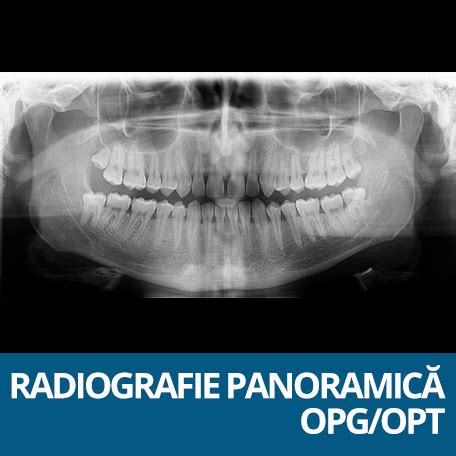 Preturi Tomografie Dentara Pret Radiografii Imagistica Dentara