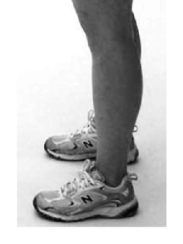 Figure From Effect Of Limiting Ankle Dorsiflexion Range Of Motion On