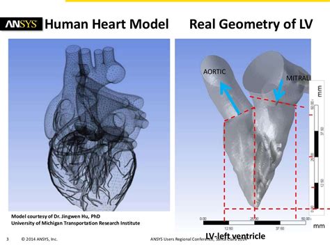 Simulations Of Hypertrophic Obstructive Cardiomyopathy Hocm In A Hu…