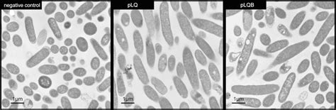 Team:Kyoto/Project/Magnetosome Formation - 2014.igem.org