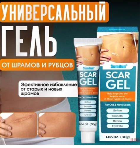 Заживляющий гель от шрамов и ожогов. Крем от рубцов и растяжек купить ...