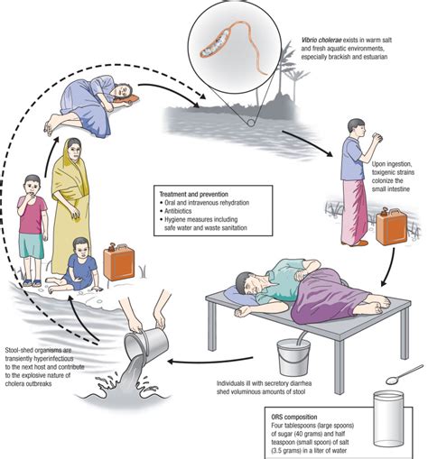 Five Health Tips To Take Against Cholera