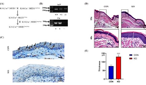 The Construction Of Med1 Epi−− Mice And The Thickness Of Oral Mucosa