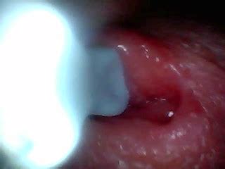 内窥镜摄像机捕捉男性射精瞬间 Pornhub Gay