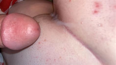 My Ass Hurts So Much Painal For The First Time Nudes Creampies NUDE PICS ORG