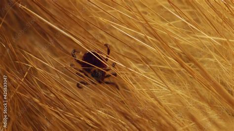 Macro Video Of Encephalitis Tick Insect Crawling On Animal Fur