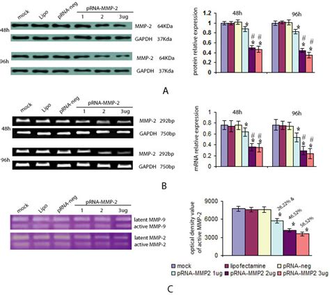 Effect of MMP-2 siRNA on ameloblastoma cells. Ameloblastoma cells were ...