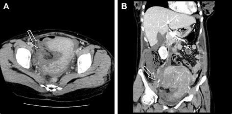 The Abdominal And Pelvic Computed Tomography Ct Scan Axial And