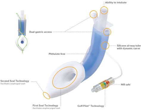 Assessing A Novel Second Generation Laryngeal Mask Airway Using The